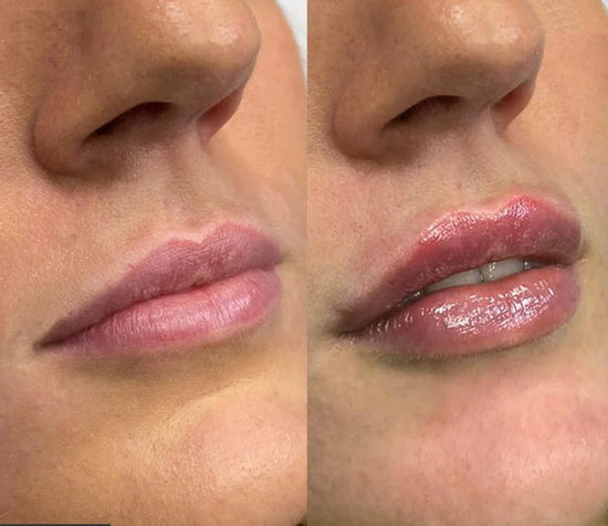 LOVILDS Glaze Craze Tinted Lip Serum, Hydrating & Moisturizing Lip Tint, Korean Lip Care, Infused with Polypeptide