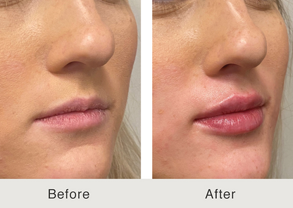 LOVILDS Glaze Craze Tinted Lip Serum, Hydrating & Moisturizing Lip Tint, Korean Lip Care, Infused with Polypeptide