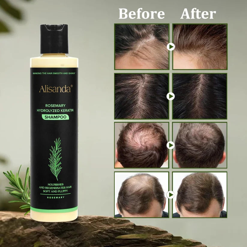 🔥LAST DAY 20% OFF - 🌿Alisanda® Organic Rosemary Hair Growth Shampoo