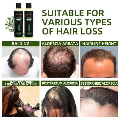 🔥LAST DAY 20% OFF - 🌿Alisanda® Organic Rosemary Hair Growth Shampoo